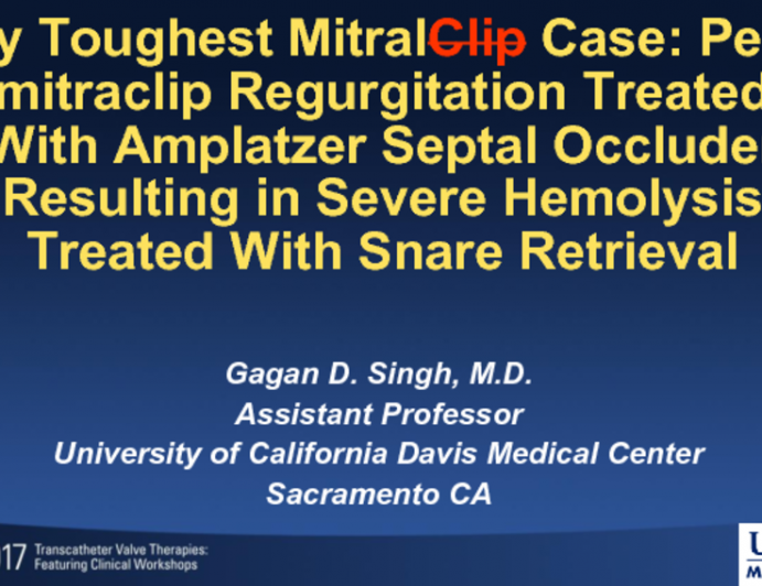 My Toughest MitraClip Case: Peri-mitraclip Regurgitation Treated With Amplatzer Septal Occluder Resulting in Severe Hemolysis Treated With Snare Retrieval