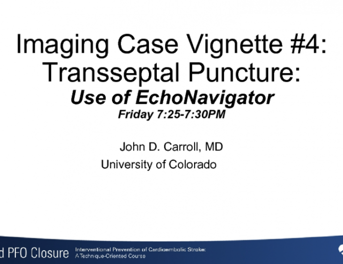 Imaging Case Vignette #4:Transseptal Puncture:Use of EchoNavigator