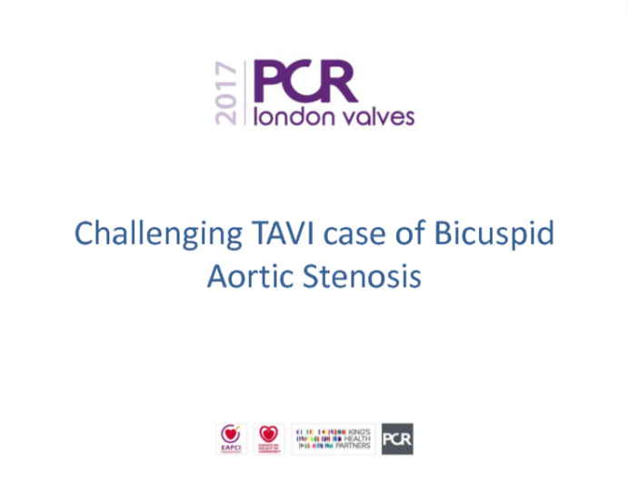 Challenging TAVI Case of Bicuspid Aortic Stenosis