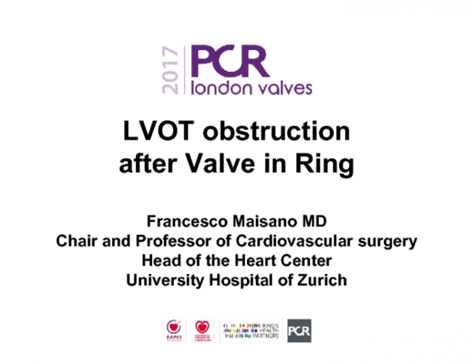 LVOT Obstruction After Valve in Ring