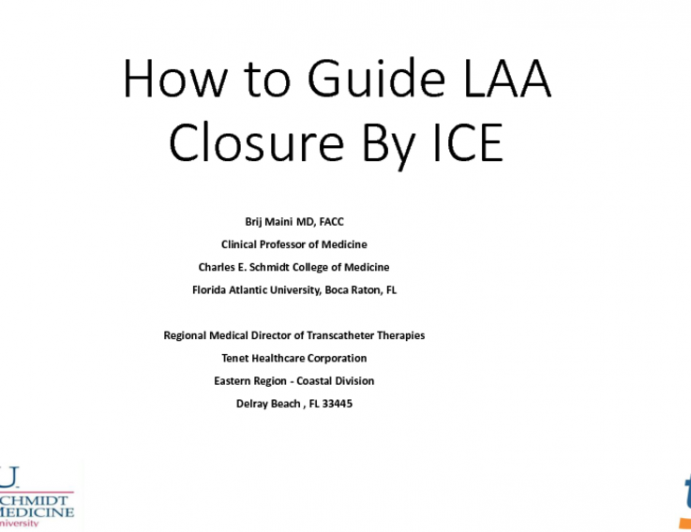 How to Guide LAA Closure By ICE