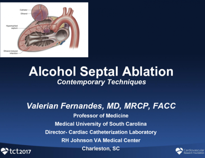 Contemporary Alcohol Septal Ablation Techniques