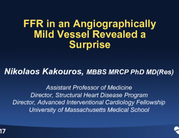 In This Case: FFR in an Angiographically Mild Vessel Revealed a Surprise (With Discussion)