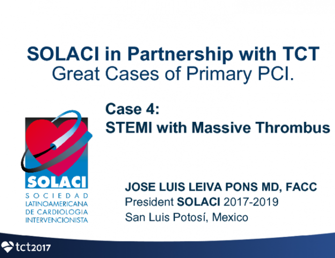 Case #4: STEMI With Massive Thrombus