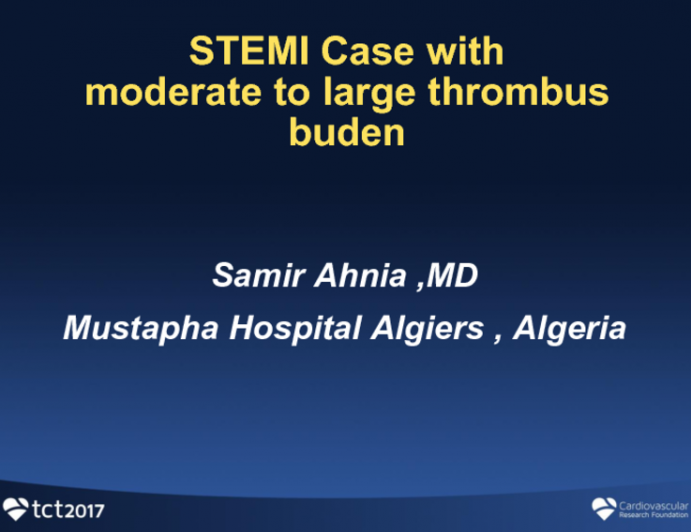 Case Presentation: STEMI With Moderate to Large Thrombus Burden