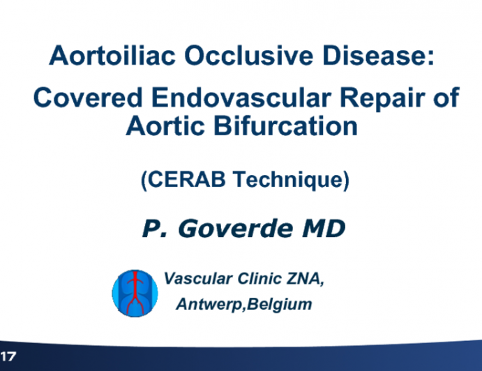 Aortoiliac Occlusive Disease: Covered Endovascular Repair of Aortic Bifurcations (CERAB Technique)