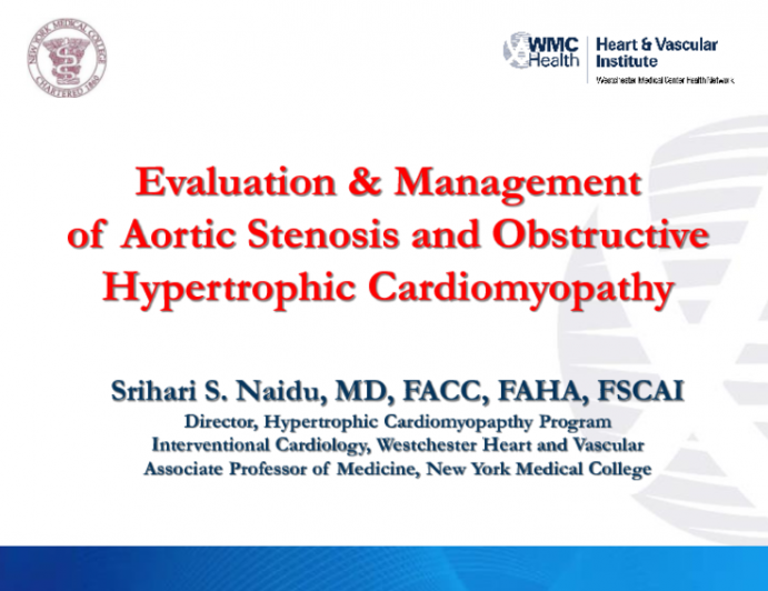 Evaluation and Management of AS With Obstructive HCM