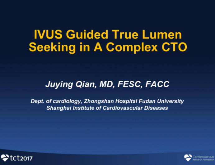 Complex Case #2: IVUS Guided True Lumen Seeking in a Complex CTO