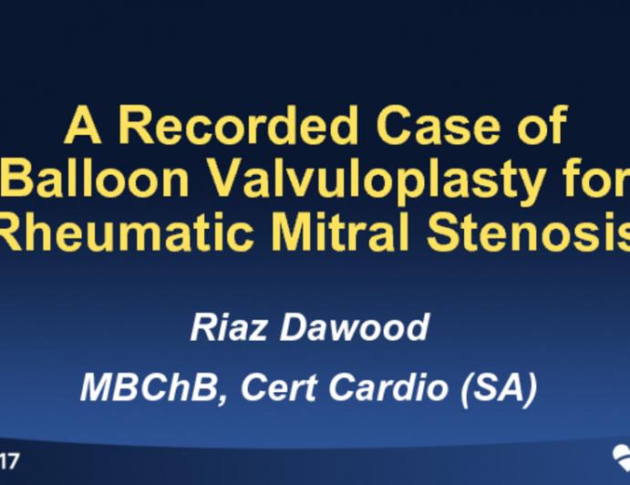 A Recorded Case of Balloon Valvuloplasty for Rheumatic Mitral Stenosis (With Integrated Discussion)