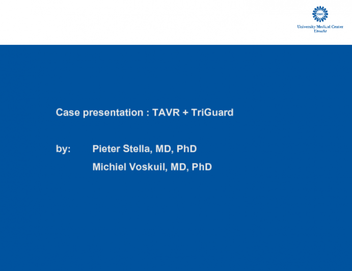 Taped and Edited Live-Case of the Use of a TriGuard Cerebral Protection Device During TAVR With Sapien 3