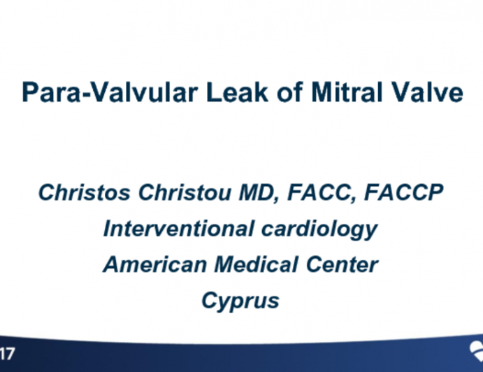 Cyprus Presents: Mitral Valve Paravalvular Leak Device Closure