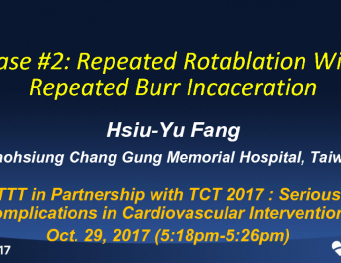 Case #2: Repeated Rotablation With Burr Incaceration