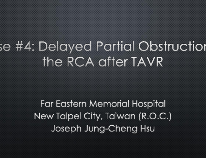 Case #4: Delayed Partial Obstruction of the RCA After TAVR