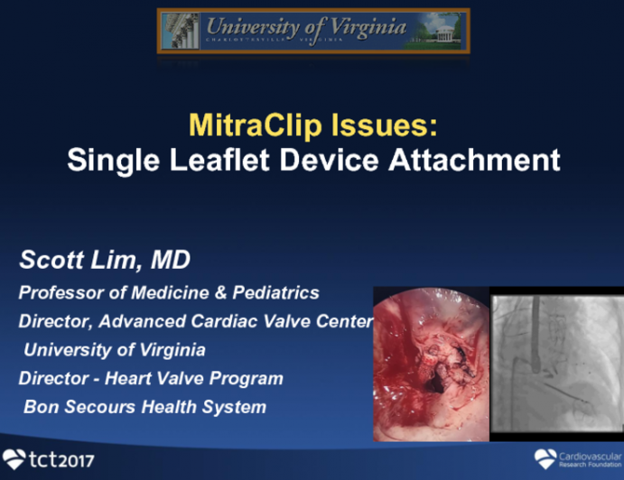Single Leaflet Detachment and Clip Embolization: Frequency, Causes, and Management