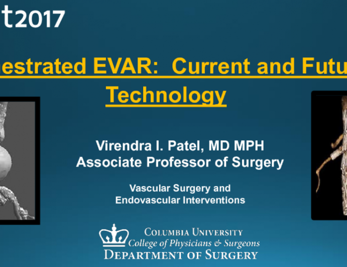 Fenestrated EVAR: Current and Future Technology