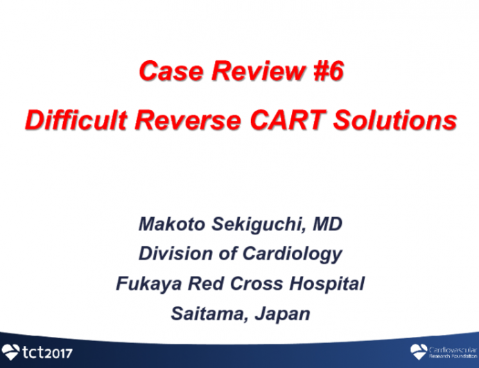 Case #6: Difficult Reverse CART Solutions (With Discussion)