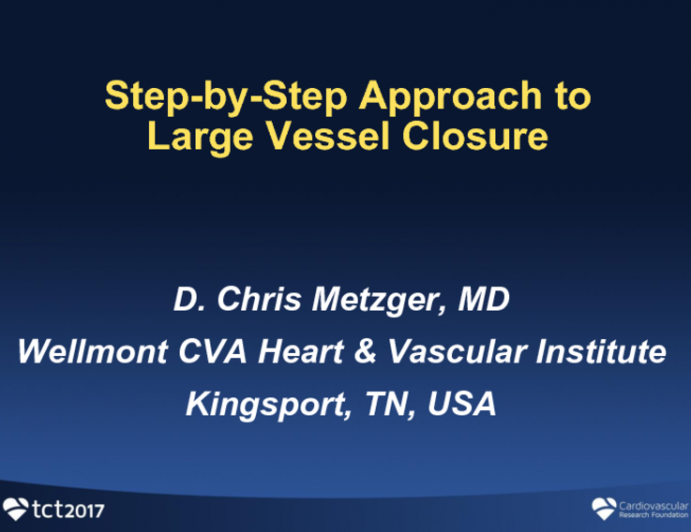 Step-by-step Approach for Large Vessel Closure