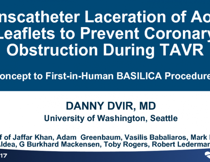 Case #1: Transcatheter Laceration of Aortic Leaflets to Prevent Coronary Obstruction During Transcatheter Aortic Valve Implantation: Concept to First-in-Human BASILICA Procedures (With Discussion)