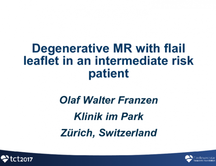 Case #3 Introduction: Degenerative MR With Flail Leaflet(S) in an Intermediate Clinical Risk Patient