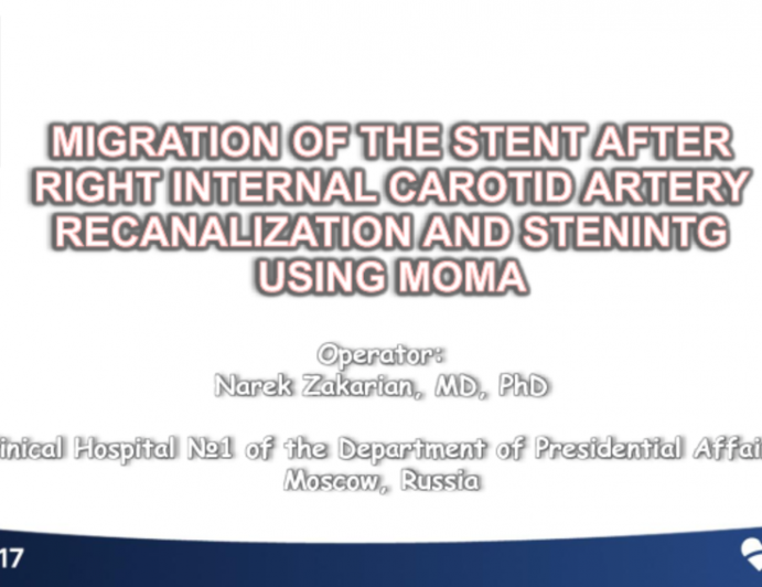 Case Presentation 4: Carotid Artery Stenting