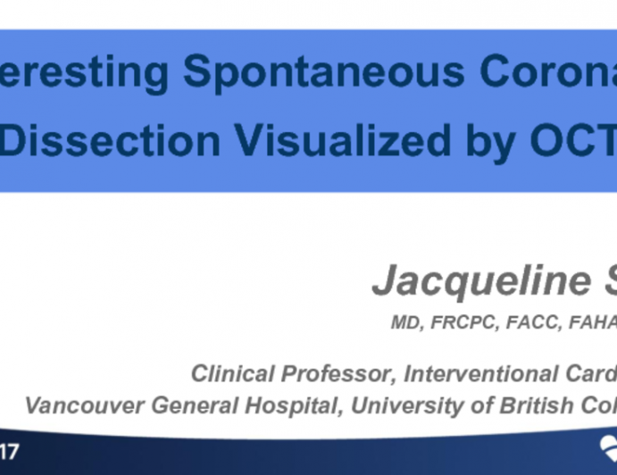 Case #5: An Interesting Spontaneous Coronary Dissection Visualized by OCT (With Discussion)