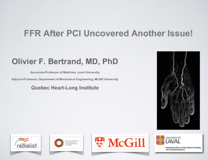 In This Case: FFR After PCI Uncovered a Major Issue (With Discussion)
