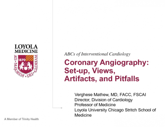Coronary Angiography: Set-up, Views, Artifacts, and Pitfalls