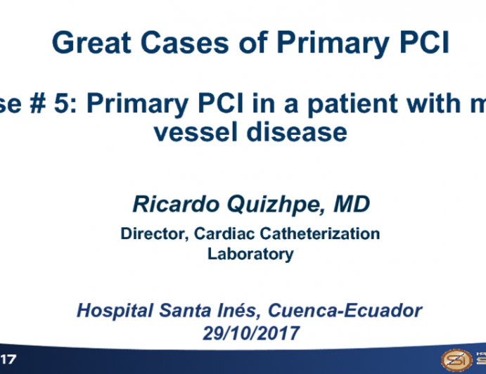 Case #5: Primary PCI in a Patient With Multivessel Disease