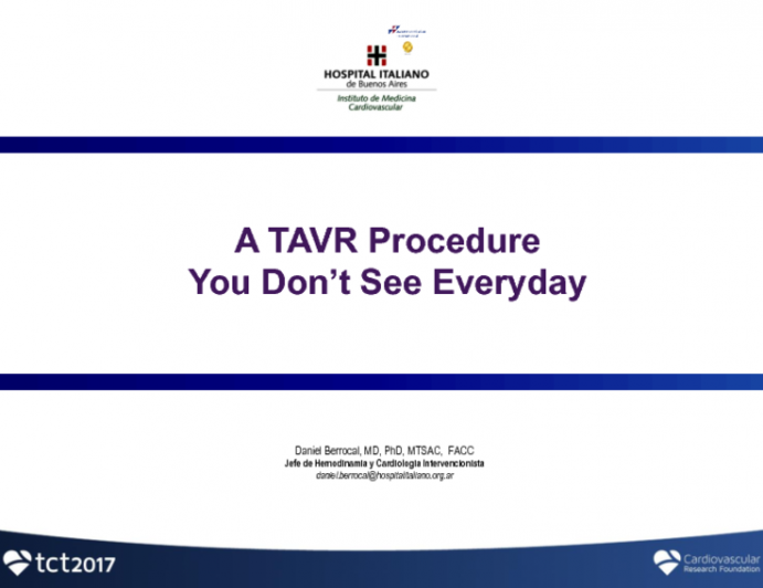 Clinical Case #2: A TAVR Procedure You Don't See Everyday