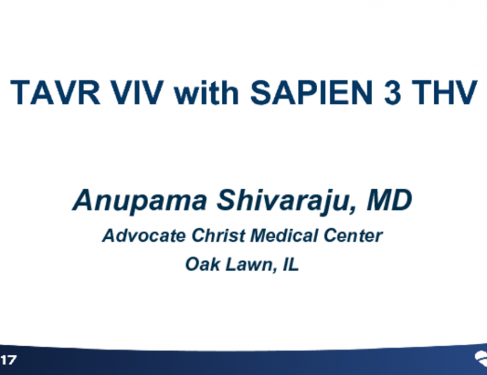 Case #2: TAVR ViV With SAPIEN 3 (With Discussion)