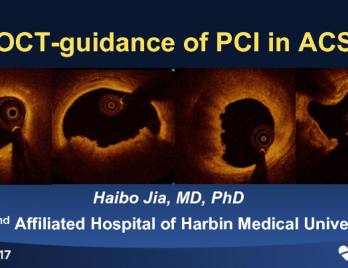 Case Presentation: OCT-Guidance of PCI in ACS