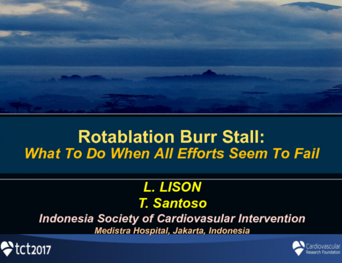 Case #2: Rotablator Burr Stall - Finding a Solution When All Efforts Fail