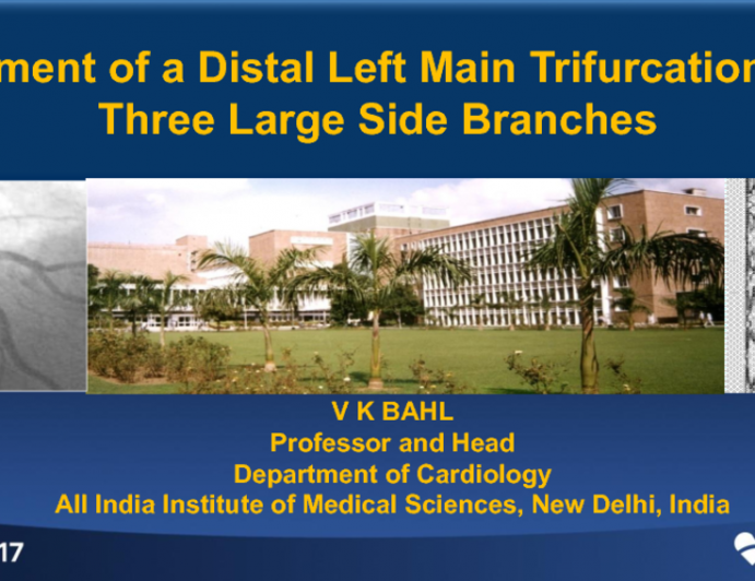 Case #10: Treatment of a Distal Left Main Trifurcation With Three Large Side Branches (With Discussion)