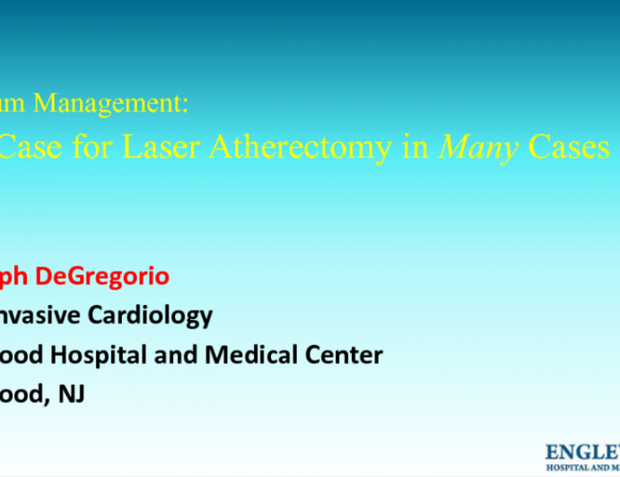 Flash Debate on Calcium Management: The Case for Laser Atherectomy in Many Cases!