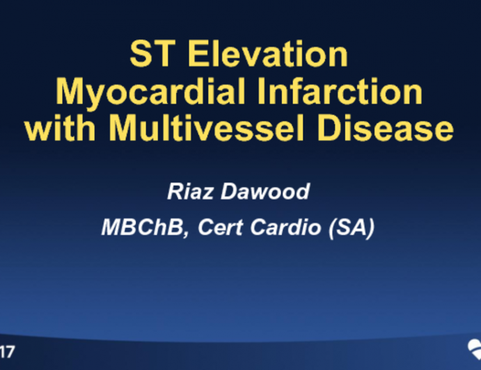 South Africa Presents a Case: STEMI With Multivessel Disease