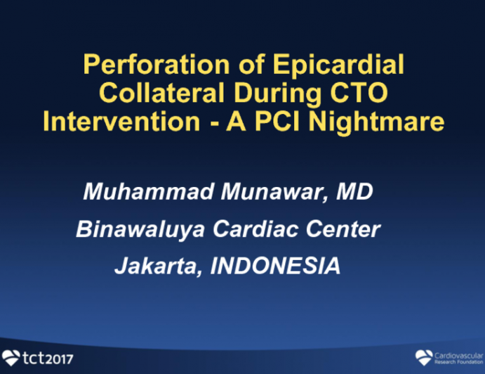 Complex Case #8: Perforation of Epicardial Collateral During CTO Intervention - A PCI Nightmare