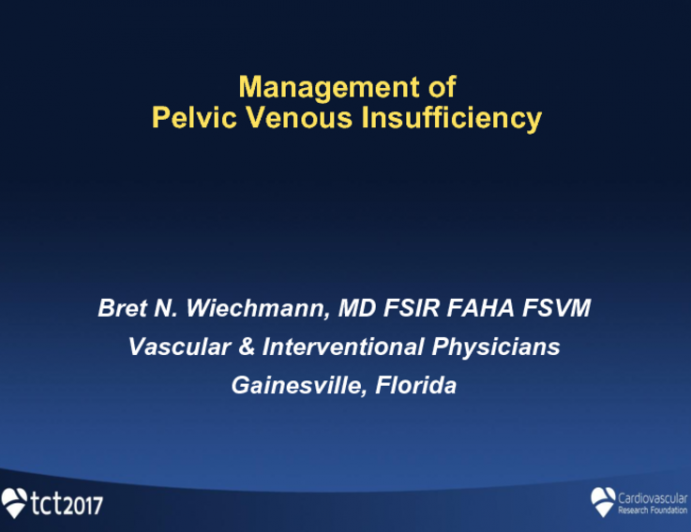 Pelvic Congestion Syndrome: Management and Developing an Office-Based Practice