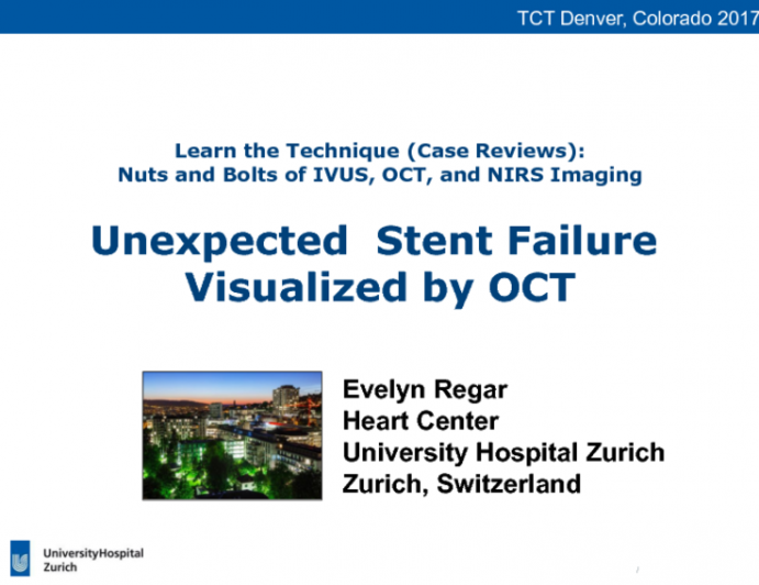 Case #8: Unexpected Stent Failure Visualized by OCT (With Discussion)