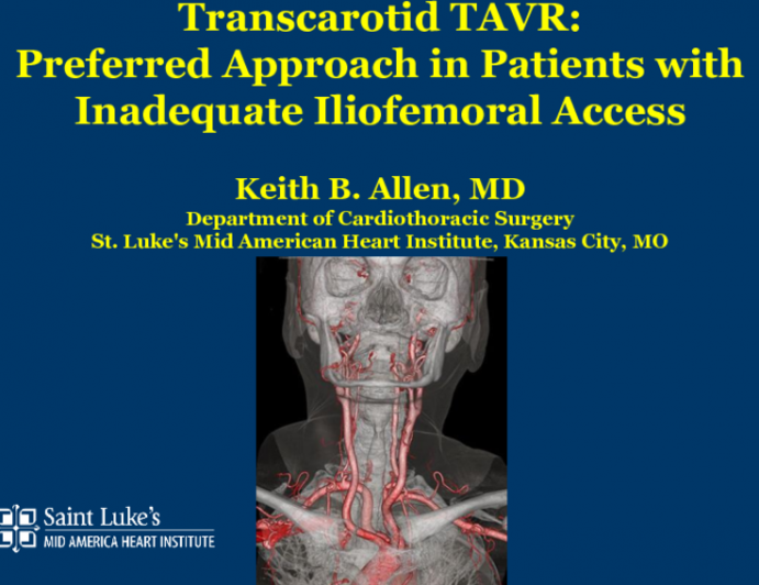 Trans-carotid Access for TAVR Is the Preferred Non-femoral Access of Choice