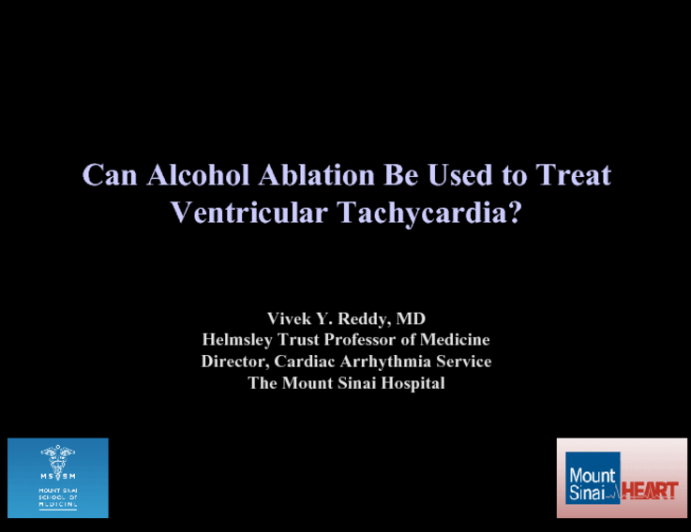 Can Alcohol Ablation Be Used to Treat Ventricular Tachycardia?