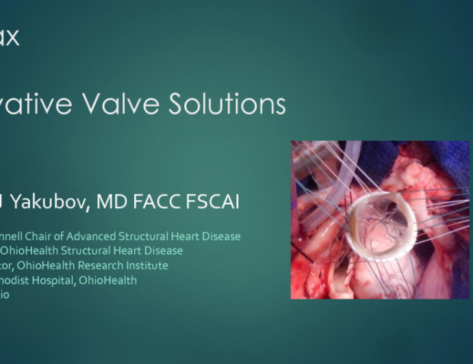 Transforming Heart Valve Performance and Manufacturing (Foldax)