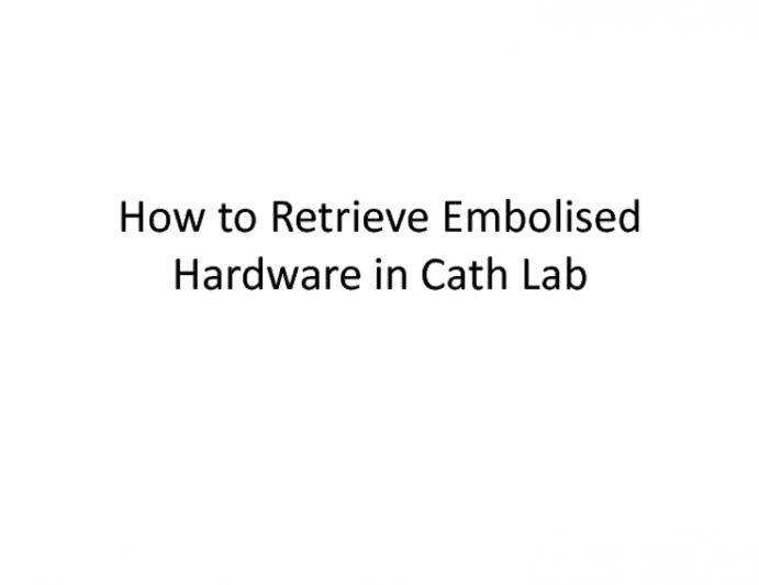 How to Retrieve Embolized Hardware in the Cath Lab