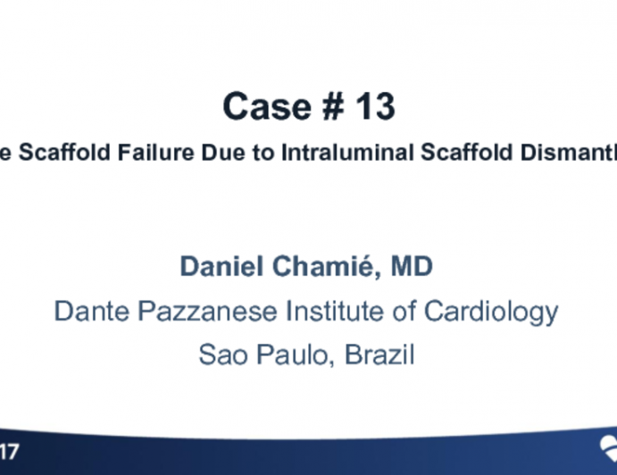 Case #13 (With Discussion): Late Scaffold Failure Due to Intraluminal Scaffold Dismantling
