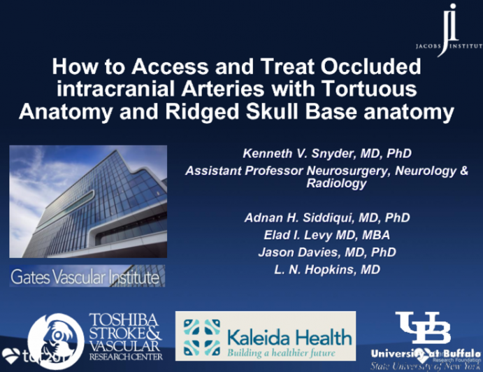 How to Access and Treat Occluded Intracranial Arteries With Tortuous Anatomy and Rigid Skull Base Arteries