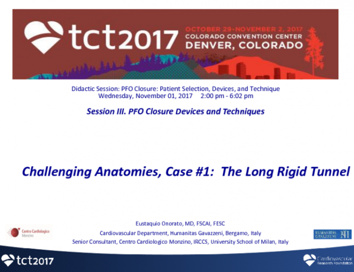 Challenging Anatomies, Case #1: The Long Rigid Tunnel