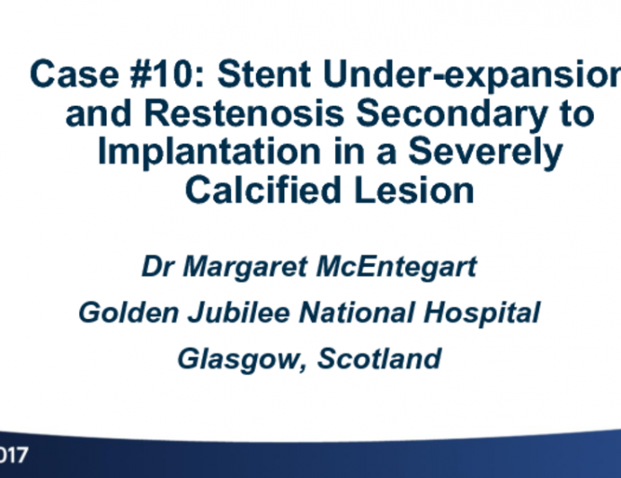Case #10 (With Discussion): Stent Underexpansion and Restenosis Secondary to Implantation in a Severely Calcified Lesion