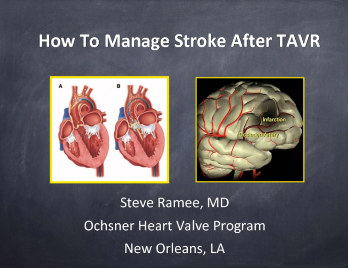 How to… Manage a Stroke After TAVR