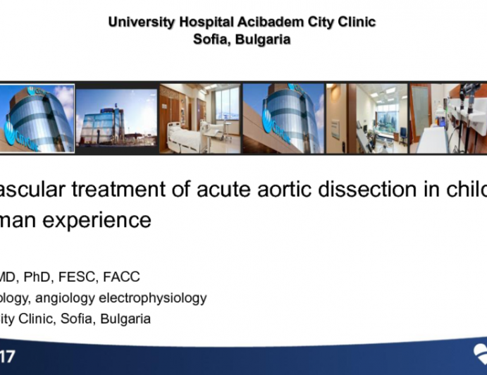 Bulgaria Presents: First in Man Experience With Endovascular Treatment of Aortic Dissection in Childhood (2 Cases)