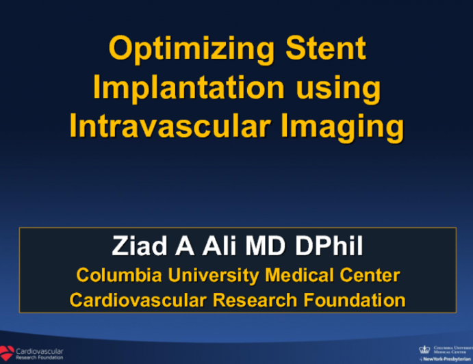 State-of-the-Art Review: Intravascular Imaging and Physiology to Optimize Stent Implantation Procedures
