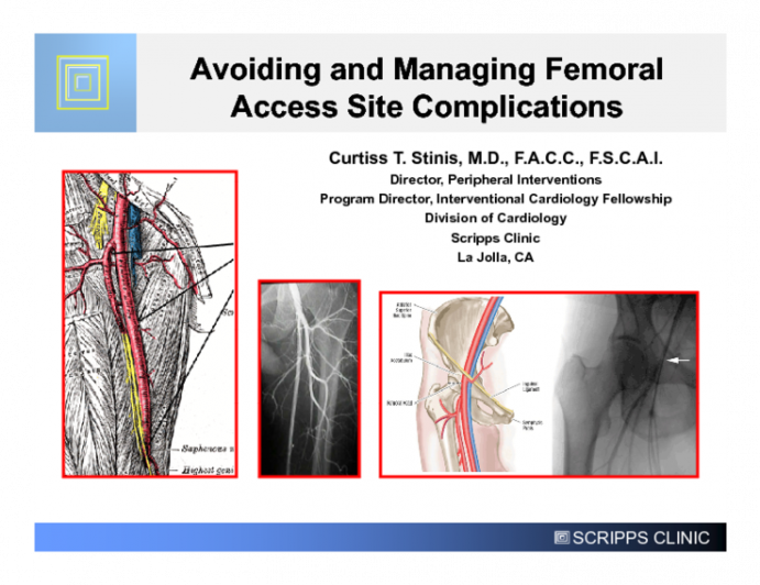Avoiding and Managing Femoral Access Site Complications